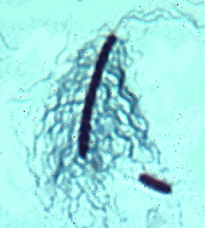 Proteus vulgaris Proteus vulgaris